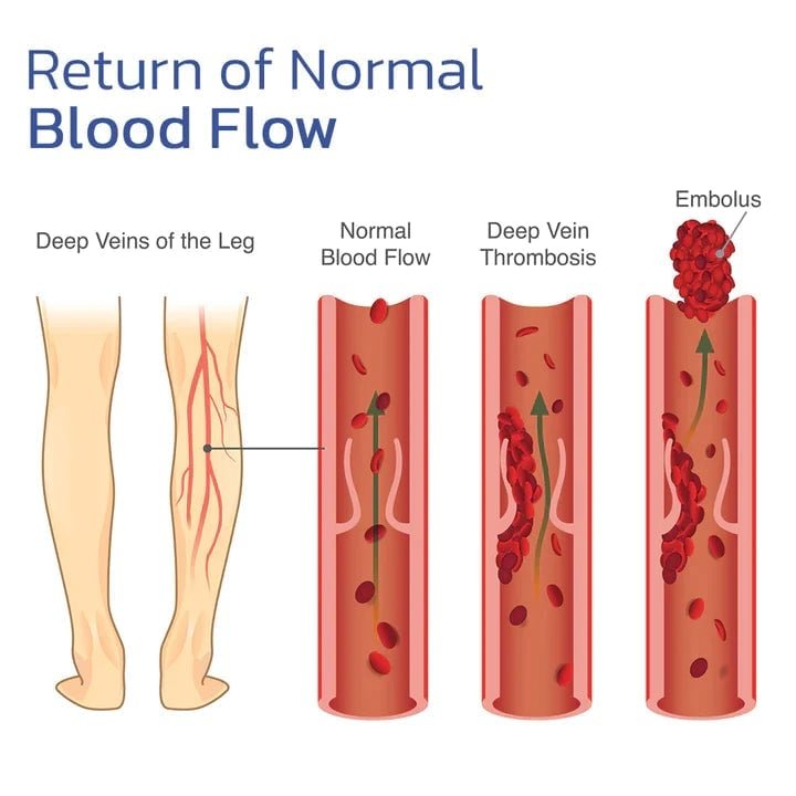 Selvoppvarmende knepute: rask lindring av smerter
