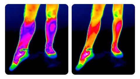 Selvoppvarmende knepute: rask lindring av smerter